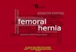 Femoral Hernias