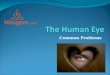 The Human Eye & Common Problems