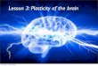 Lesson 3   plasticity rewiring of the brain 2013