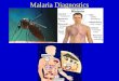 4 Malaria Diagnosis