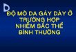 133 Do Mo Da Gay O Truong Hop Nst Binh Thuong