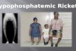 Hypophosphatemic Rickets
