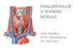 Evaluation of a thyroid nodule by vijay