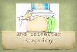 2nd trimester scan