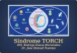 Sindrome torch