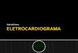 Eletrocardiograma CURSO