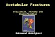 26. acetabular fractures   anatomy, evaluation and classification  - muhammad abdelghani