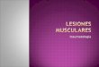 Lesiones Musculares