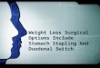 Weight loss surgical options include stomach stapling and duodenal switch
