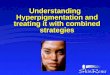 Understanding Hyperpigmentation and Treating with Combined Strategies  - NEW Yellow Peel Protocol