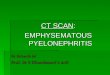 CT: Emphysematous Pyelonephritis