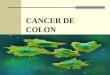 Cancer de-colon