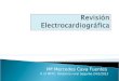 Revisión electrocardiografica