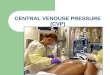 CENTRAL VENOUSE PRESSURE (CVP)