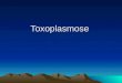 Infectologia - Toxoplasmose