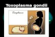 Toxoplasma gondii exposicion
