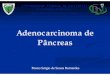 Adeno Carcinoma de Pancreas
