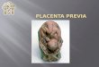 Placenta Previa Fanny Termin