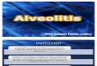 Alveolitis y pericoronitis