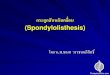 กระดูกสันหลังเคลื่อน (Spondylolisthesis)