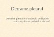Derrame Pleural - Cezar Nery