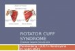 rotator cuff syndrome