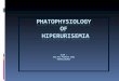 Patofisiologi Hiperurisemia