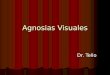 Agnosias visuales