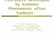 Psoriasis Developed By Koebner Phenomenon After Radiation Therapy