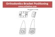 Orthodontics bracket positioning-SANDID-O-pdf