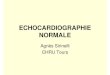 Echocardiographie normale