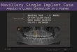 2 basic fabrication  maxillary single implant
