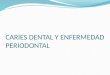 caries y enfermedad periodontal