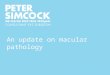 A macular pathology and oct update for optometrists