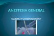 Anestesia general 