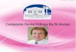 Composite Dental Fillings By Dr. Kezian