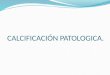 Calcificación patologica