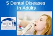 5 dental diseases in adults