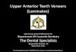 Upper anterior teeth veneers (Laminates)
