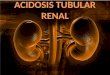 Acidosis tubular renal tipo 2 y 4