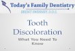 Tooth Discoloration: What You Need To Know