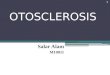 Otosclerosis ENT