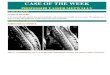 Case record...Acute postinfectious transverse myelitis (Transverse myelitis spectrum of disorders)