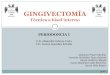 Gingivectomia bisel interno