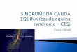 Sindrome da cauda equina (cauda equina syndrome