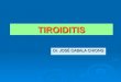 5. tiroiditis