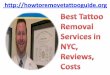 Best tattoo removal services in nyc, reviews, costs