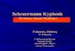 Scheuermann kyphosis crete 2009 - K†‰ƒ·