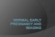Normal early pregnancy  imaging