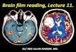 Presentation1.pptx, brain film reading, lecture 11